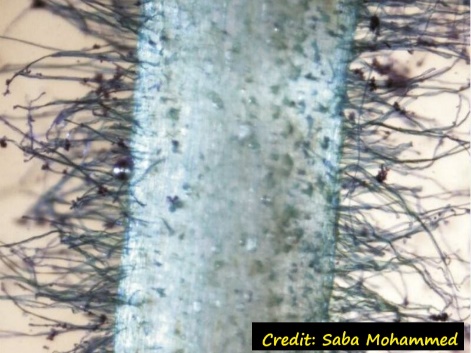 D:\GRSV Consultancy Service\AgriTech news\38_ATN\A high-resolution root hair image taken from a cowpea seedling root sample.jpg